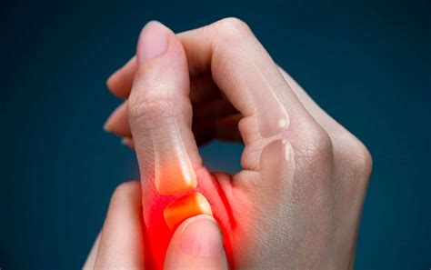 How To Relieve Thumb Joint Pain