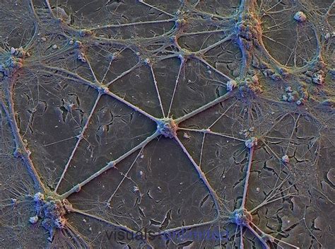 Human Brain Cortex Neurons With Network Of Neurons Microscopic