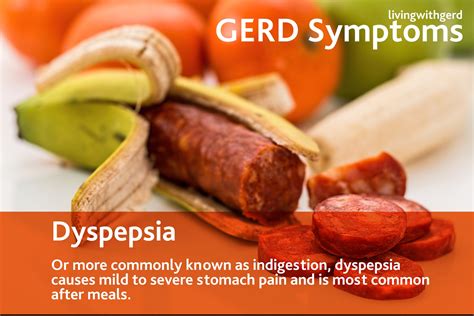 Gerd Symptoms
