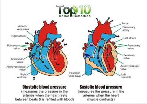 If left untreated, hypertension is a severe threat to the my cat has been diagnosed with a heart murmur and hig bp. Home Remedies for High Blood Pressure | Top 10 Home Remedies