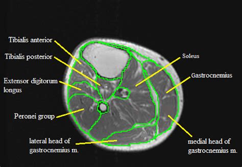 Scroll through the structures to understand the anatomy. MRI analysis and clinical significance of lower extremity ...