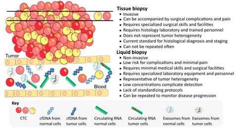 The Advantages And Disadvantages Of A Tissue Biopsy In Comparison With
