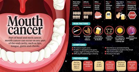 Infographicwhat You Should Know About Mouth Cancer New Straits Times