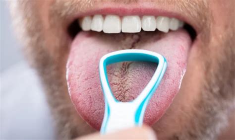 Understanding Tongue Dark Spots Causes And Solutions Health Guide