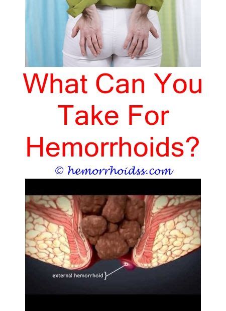 How To Stop Itching Internal Hemorrhoids Can Hemorrhoids Cause Narrow Bowel Movements How Long