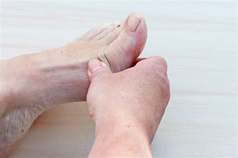 Ganglion Cysts Foot And Ankle Institute Of The West