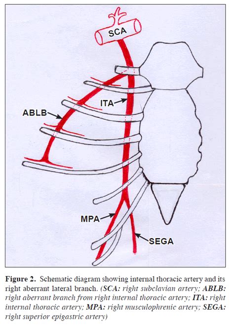 An Aberrant Right Lateral Branch From Right Internal Thoracic Arteryside