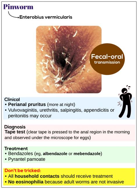 Enterobius Vermicularis Pinworm Medicine Keys For Mrcps