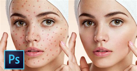 Photoshop Tutorial The 5 Best Ways To Clean And Heal Skin Blemishes