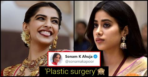 Sonam Kapoor Makes Shocking Statement On Actresses Having ‘plastic