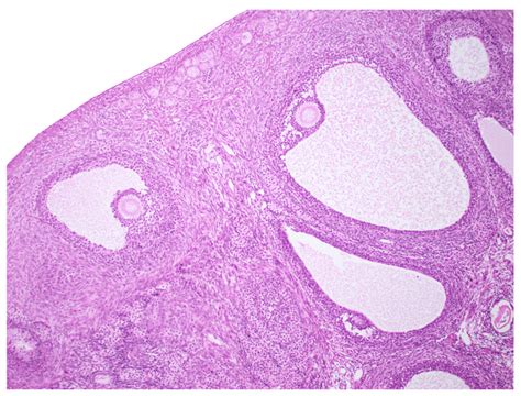 Reproductive Ovary Histology Zoom Diagram Quizlet