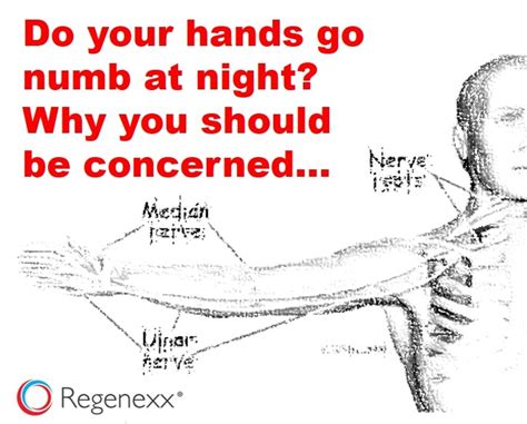 Hands Numb While Sleeping Dont Ignore This Sign Regenexx®