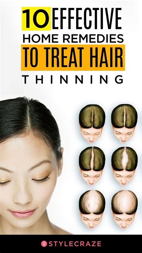 How to tell the difference. 10 Home Remedies + Prevention Tips For Thinning Hair ...