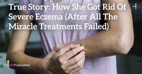 This Is What Your Dermatologist Doesnt Tell You About Eczema