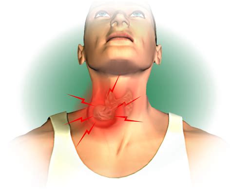 Douleur Thyroide Inflammation De La Thyroïde Symptômes Aep22