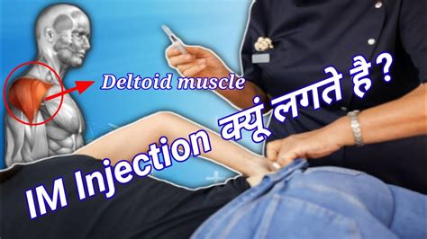 Intramuscular Injection Sites Intramuscular Injection Deltoid Muscle Iv Injection Buttock