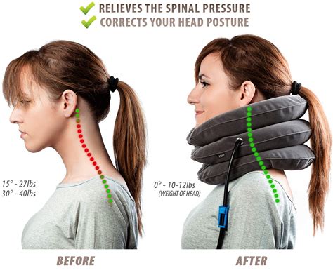 Buy Pinched Nerve Neck Stretcher Cervical Traction Device For Home Pain