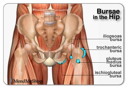 Hip Bursitis Information And Treatments