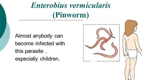 Enterobius Vermicularis Ova