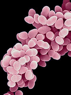 We did not find results for: Must-Know MRSA Facts - Skin and Beauty - Everyday Health
