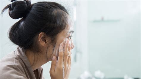 9 Acne Mistakes Youre Making And How To Fix Them