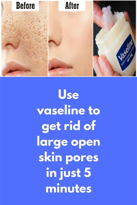 use vaseline to get rid of large open skin pores in just 5 minutes today i am going to share one