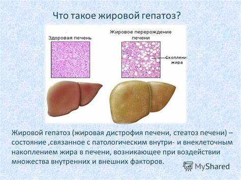 Если у кошки дистрофия печени - фото презентация Картинка - Если у кошки дистрофия печени - фото презентация