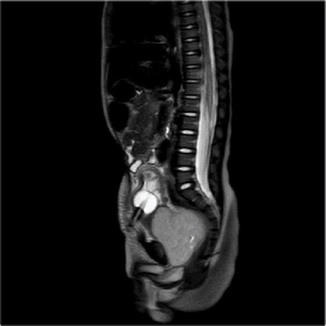 Chest Ct With Abdomen And Pelvis Sagittal View Download Scientific