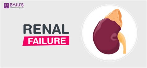 Chronic renal failure is a slow, progressive decline of kidney function. What Is Renal Failure? - Causes, Types and Symptoms