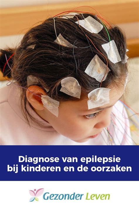 Diagnose Van Epilepsie Bij Kinderen En De Oorzaken In 2021 Genetica