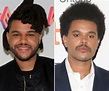 The Weeknd Before and After Plastic Surgery Journey - Vanity