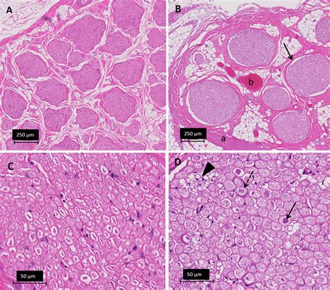 Histology Of The Peripheral Nerves And Light Microscopy My XXX Hot Girl