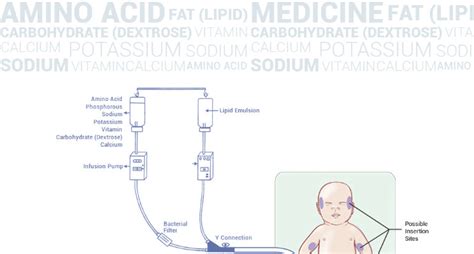 Total Parenteral Nutrition Tpn For Preterm Babies