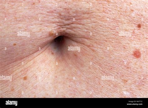 The Surface Of The Stomach Skin And Navel Of The Elderly Old Woman A