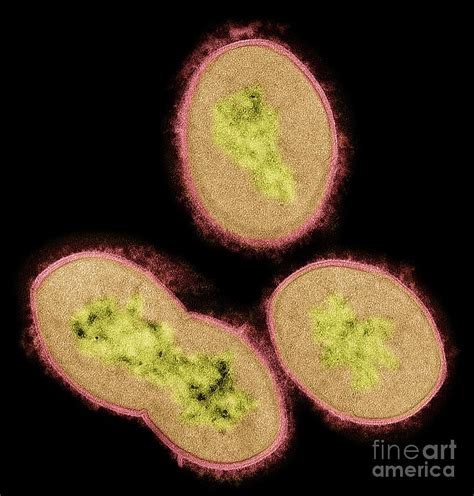 Streptococcus Bacteria Photograph By Steve Gschmeissnerscience Photo