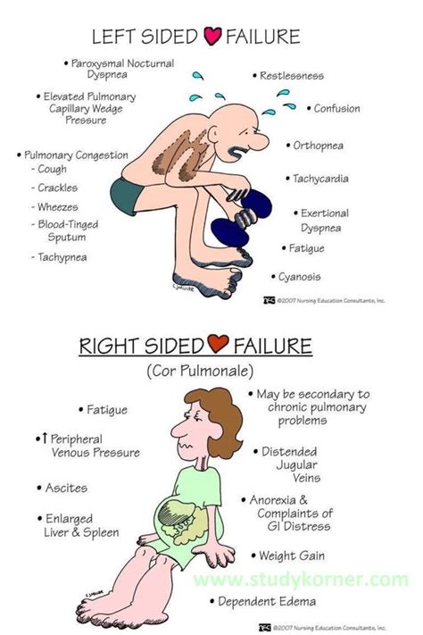 Nursing Left Sided Heart Failure Studypk