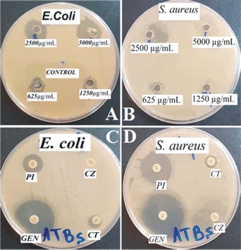 The Antibacterial Activity By Agar Well Diffusion And Antibiotics Disk