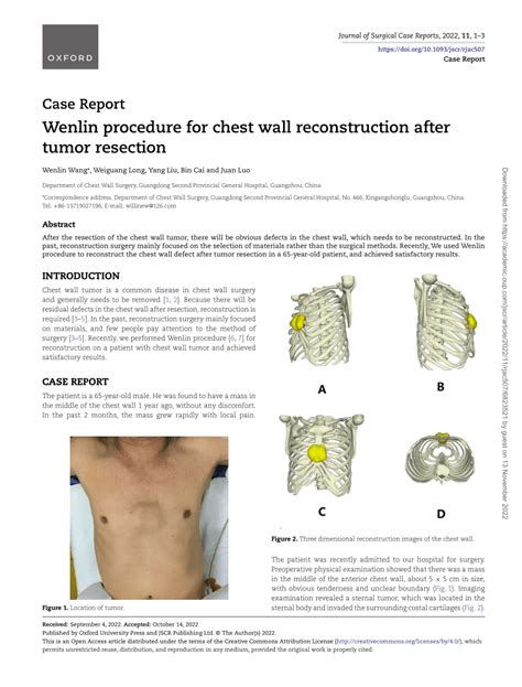 Pdf Wenlin Procedure For Chest Wall Reconstruction After Tumor Resection