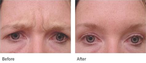 Make sure to include face massages. Fidgety Fingers: DO FACIAL MASSAGES REALLY WORK?