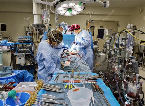 Open Heart Surgery Stock Image C0380694 Science Photo Library