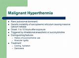 Malignant Hyperthermia Medication Images