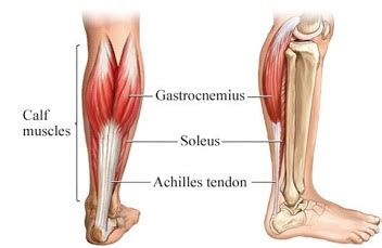 The plantaris tendon extends to the medial surface just proximal to the level of fusion and extends distally to its insertion. Gastroc/Soleus Equinus -Achilles Tendinitis-Structural ...