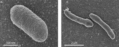 New Life Form Answers Question About Evolution Of Cells Eurekalert