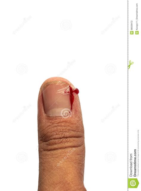 Bleeding Wound On Finger At Right Hand With White Stock Photo Image