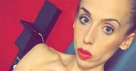 Anorexic Woman Whose Weight Plunged To St Gets Back To Health To Serve As Identical Twin S