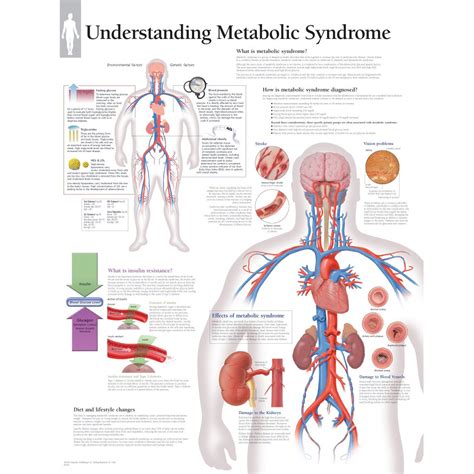 Scientific Publishing Understanding Metabolic Syndrome Chart