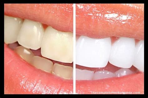 how to remove coffee stains from teeth at home coffee stained teeth 5 ways to save your teeth