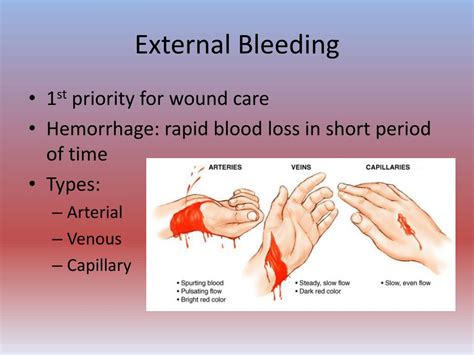Ppt First Aid Lecture Bleeding And Shock Powerpoint Presentation