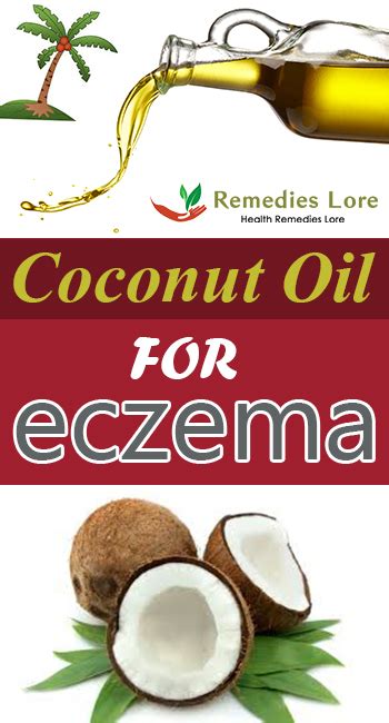 Coconut Oil For Eczema Remedies Lore