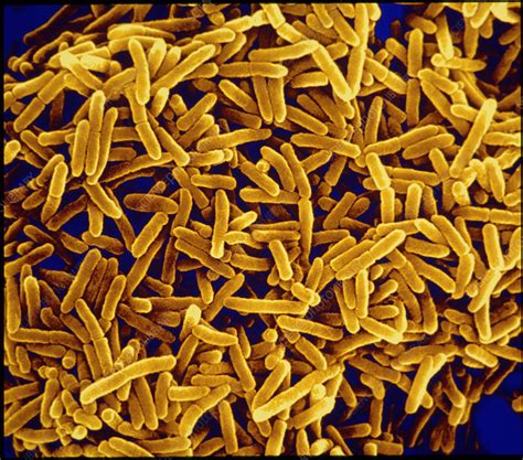 Pseudomonas Aeruginosa Bacteria Stock Image B2201089 Science